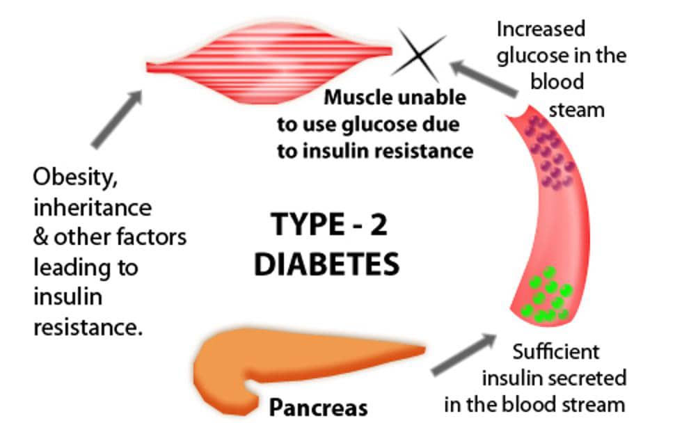 6 Essential Conditions Why Some Patients Need Insulin Injections To Treat Diabetes ? Diabetes type 2 ancient diabetes reversal