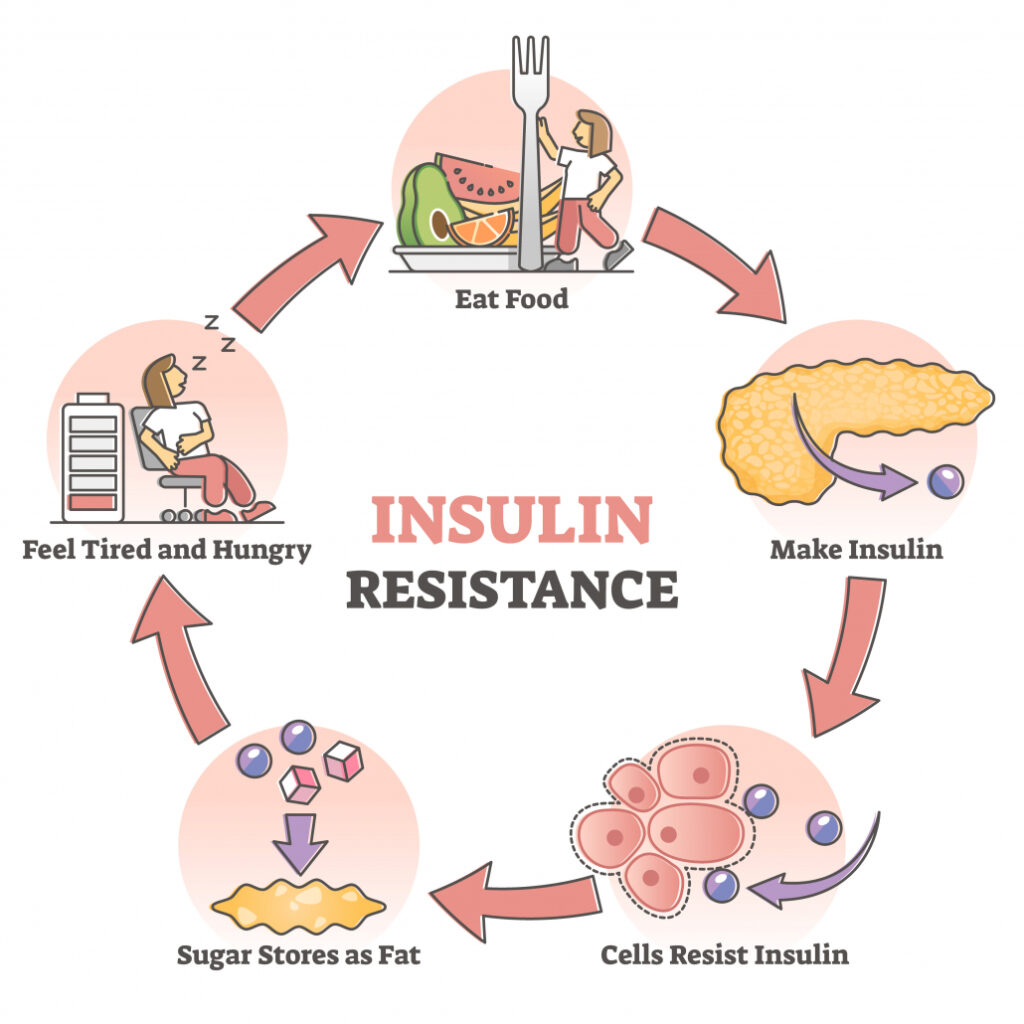 6 Essential Conditions Why Some Patients Need Insulin Injections To Treat Diabetes ? 4 insulin resistent ancient diabetes reversal
